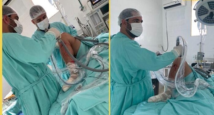 16 cirurgias de joelho neste fim de semana no Hospital São Lucas de Itabirinha, veja mais …