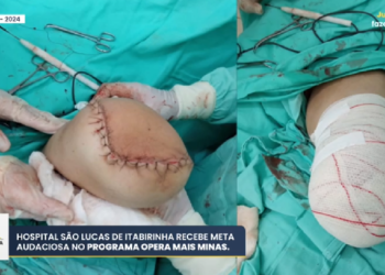 Itabirinha é contemplada com Programa Opera Mais Minas Gerais e deve ampliar os serviços de cirurgias eletivas na região
