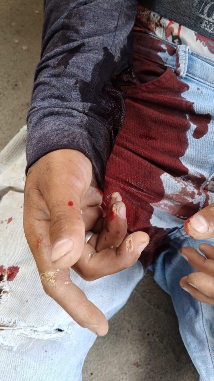 Imagem Do Dia: Homem encosta parte metálica em instalação elétrica e toma forte choque  quando preparava para colocar placas solares em telhado