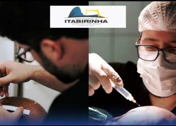 Itabirinha comemora um marco na área da saúde: O primeiro implante capilar realizado na cidade!
