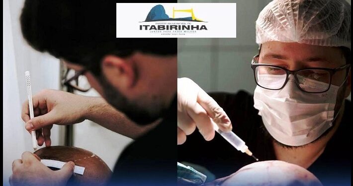 Itabirinha comemora um marco na área da saúde: O primeiro implante capilar realizado na cidade!